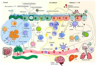 Gut microbiota: a crucial player in the combat against tuberculosis